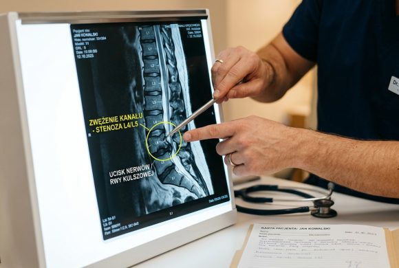 Stenoza (zwężenie) kanału kręgowego a rwa kulszowa – jak je rozpoznać i leczyć Stenoza (zwężenie) kanału kręgowego a rwa kulszowa – jak je rozpoznać i leczyć